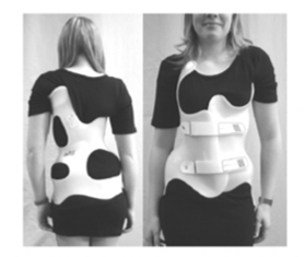 脊柱側(cè)彎穿戴