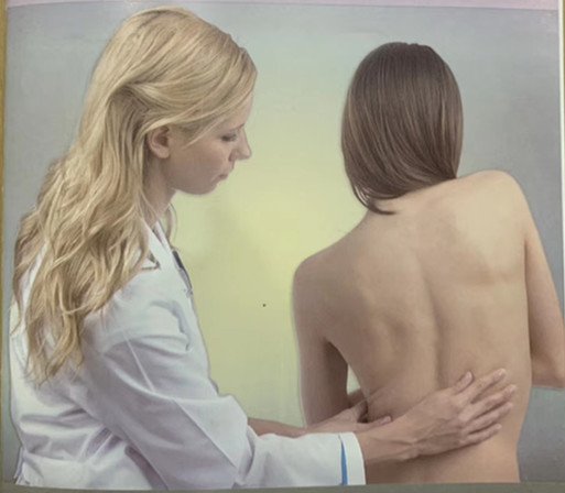 脊柱側彎早發(fā)現(xiàn)，早治療