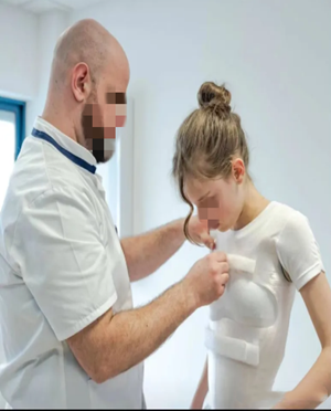 脊柱側(cè)彎支具