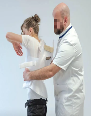 脊柱側(cè)彎支具