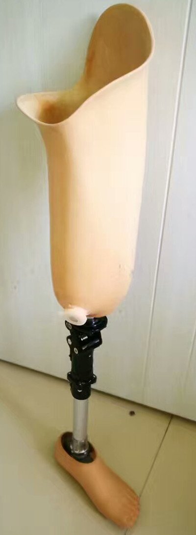 大腿假肢