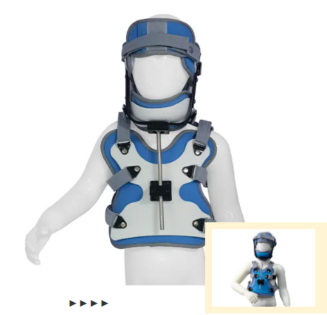 兒童斜頸的治療的