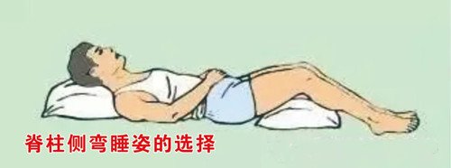 睡姿不正確會(huì)對(duì)脊柱側(cè)彎產(chǎn)生影響嗎？