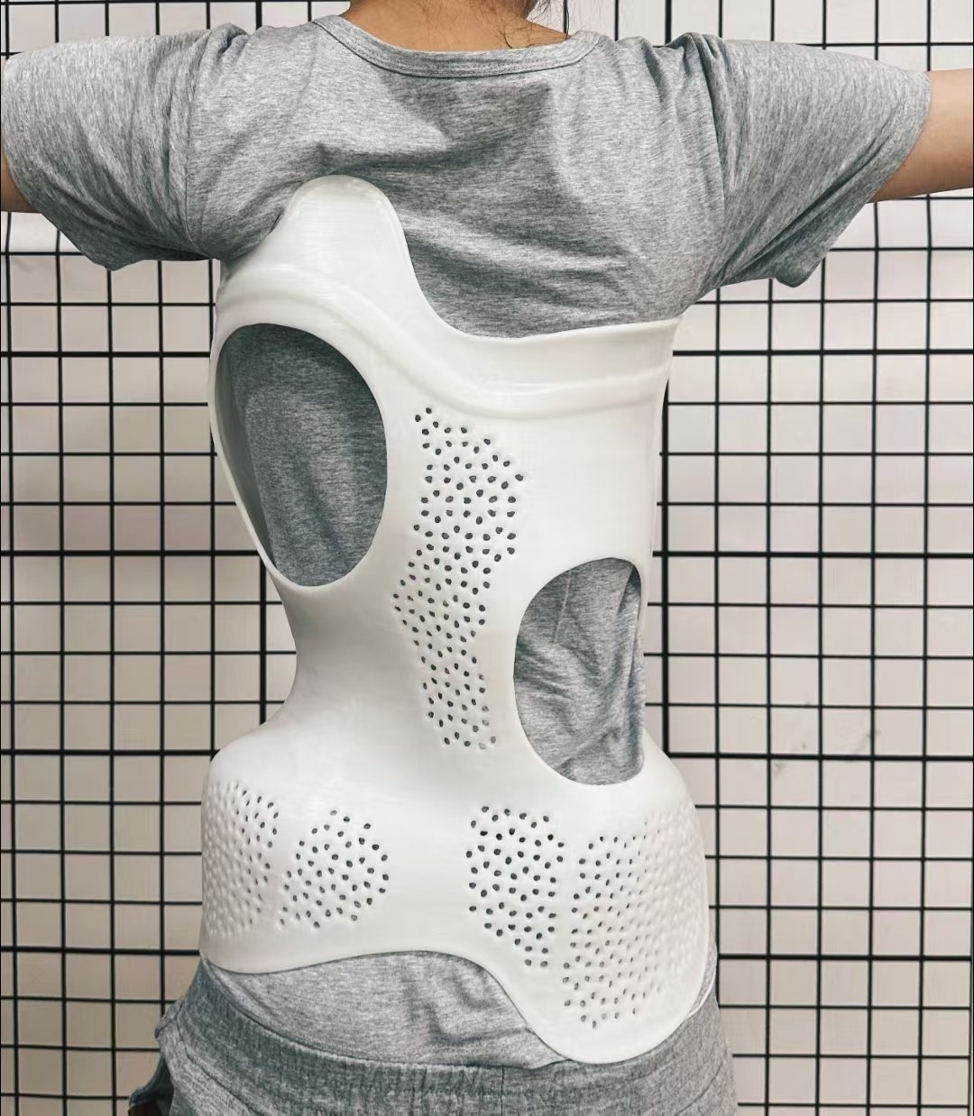 脊柱側(cè)彎支具穿戴3個月要及時復查