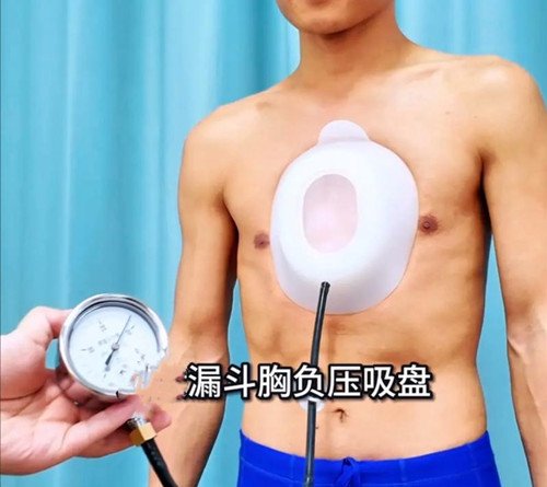 漏斗胸怎么矯正？