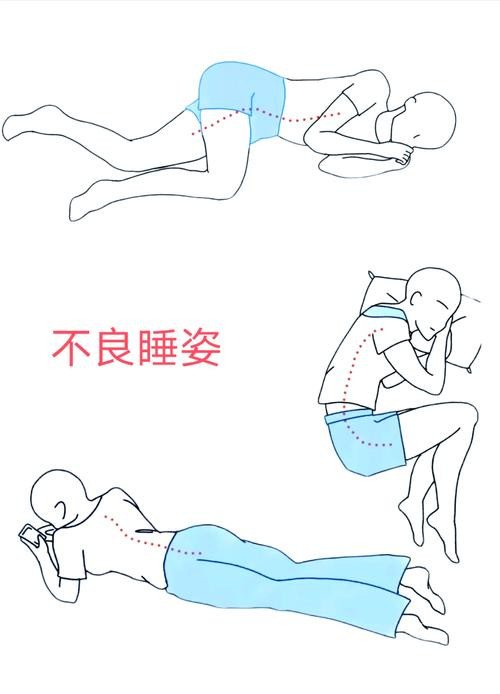 睡姿對脊柱側(cè)彎患者的影響